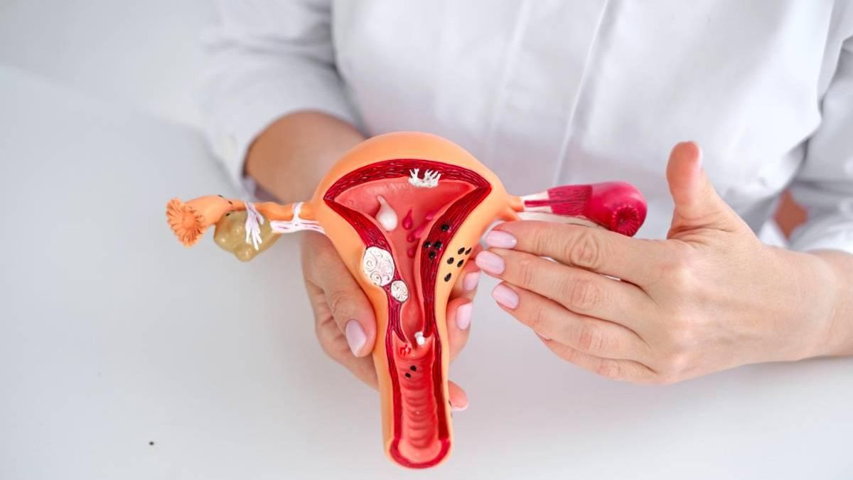 Día Mundial de la Endometriosis: ¿por qué se celebra el 14 de marzo?