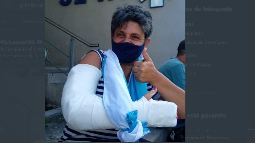 Concejala formoseña denuncia que le pegaron seis balazos de goma en la represión