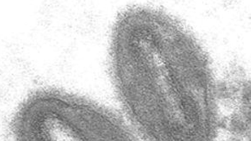 Virus que causa la viruela del mono. / Wikipedia