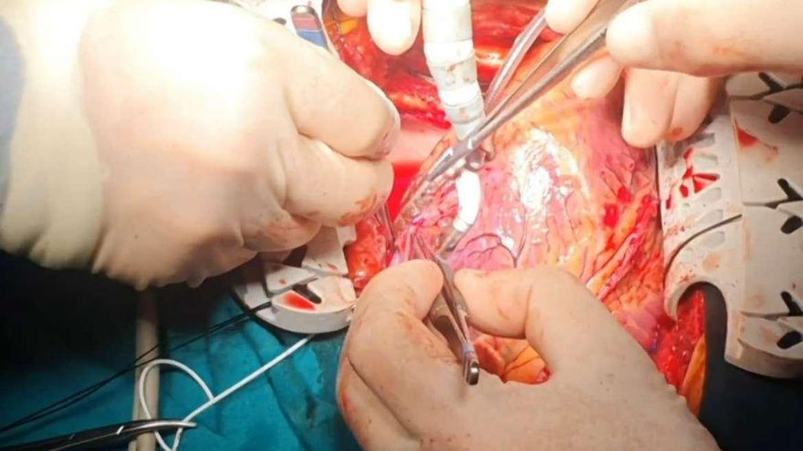 Salud asegura que las prótesis caducadas de la trama murciana no se utilizaban en pacientes