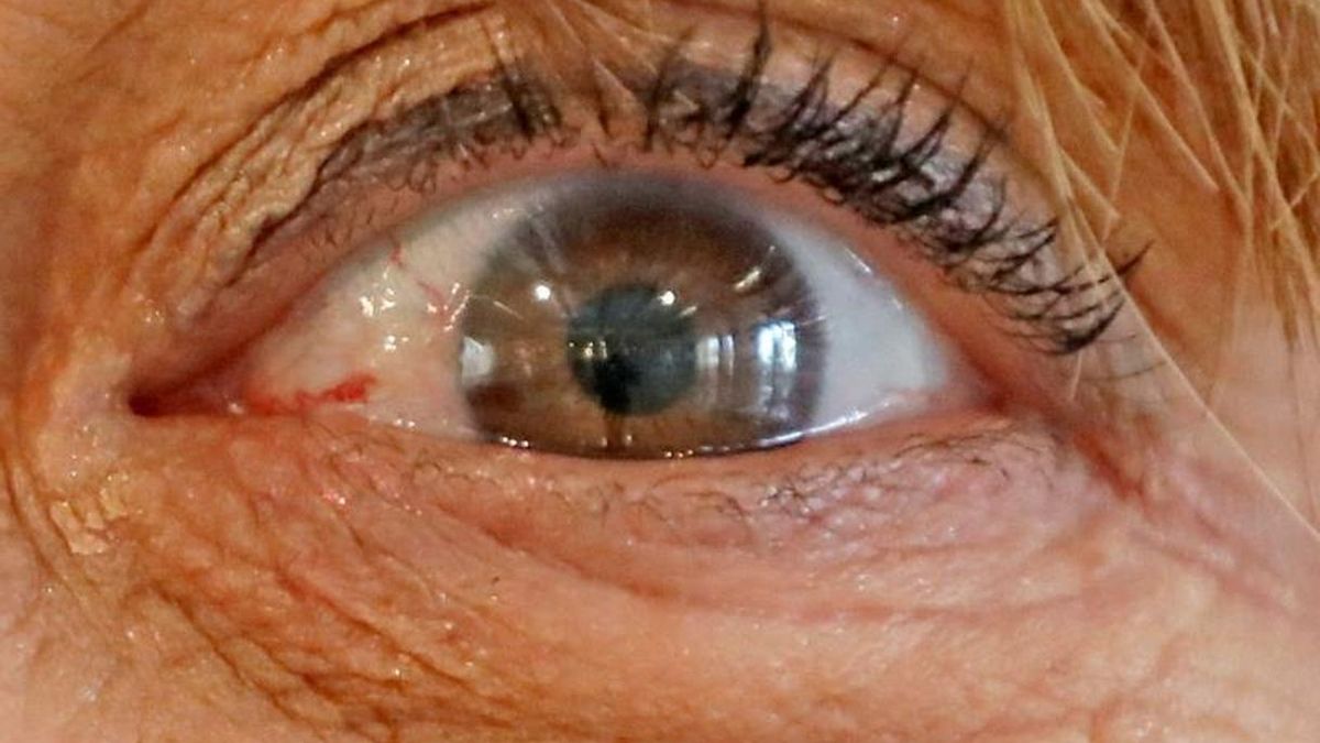 El SES indemnizará con 61.000 euros a un vecino de Oliva de Plasencia por el retraso en diagnosticarle un desprendimiento de retina