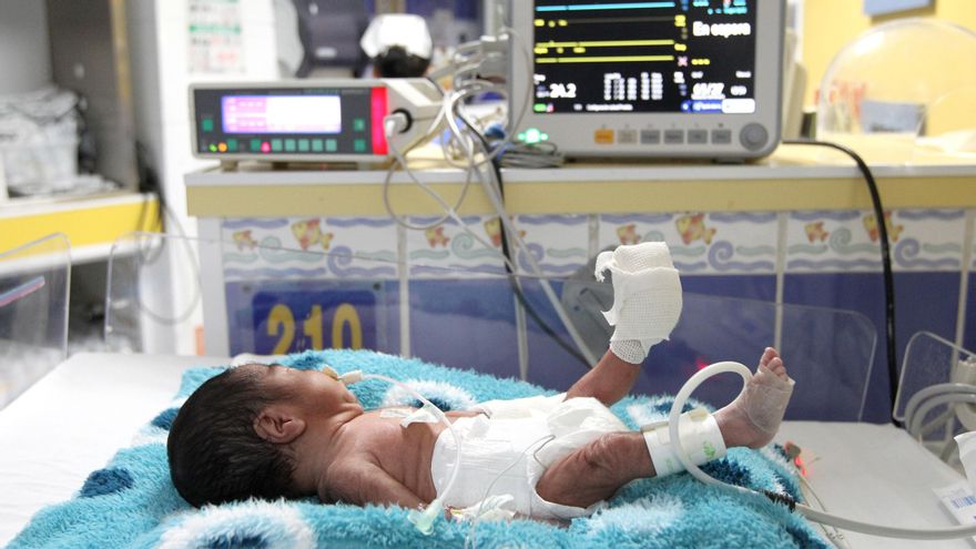 Un bebé prematuro en una incubadora. Foto de archivo