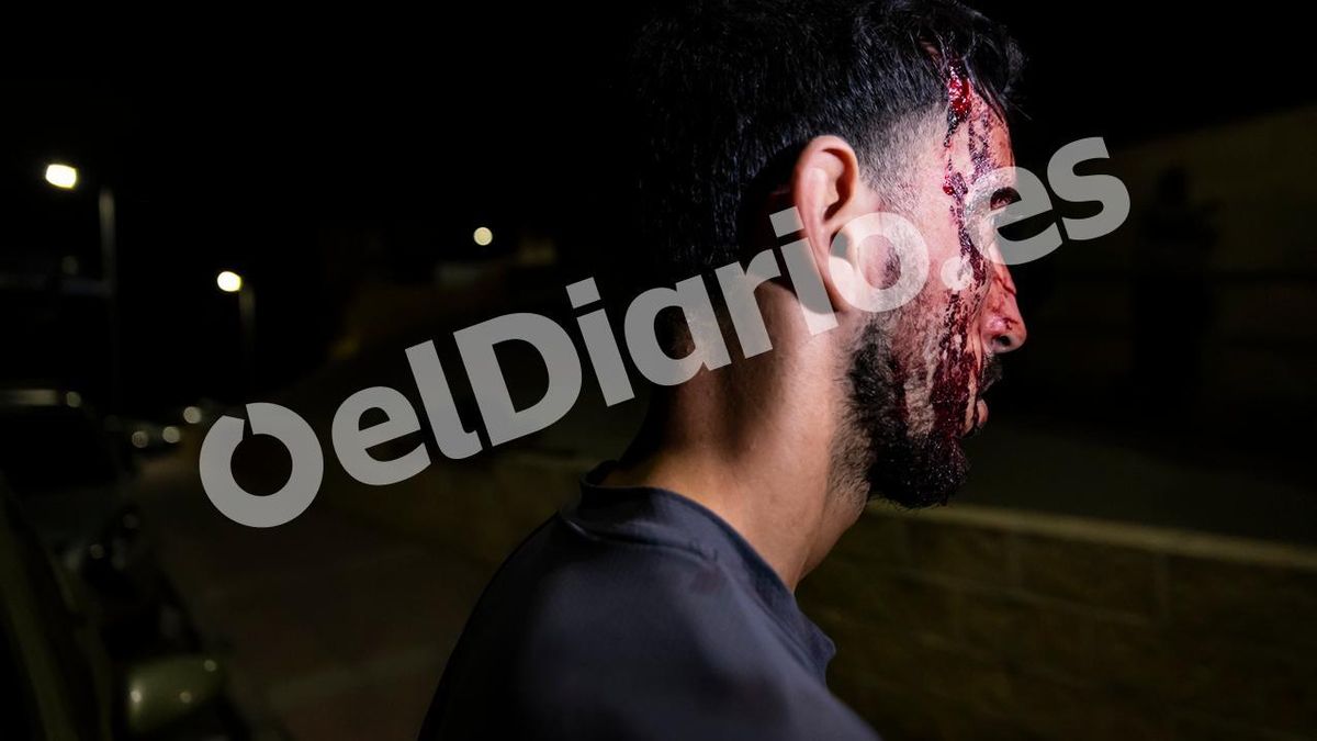 Uno de los hombres marroquíes que denuncian haber sufrido una paliza por un grupo de militares, entre los que se encontraban legionarios, durante una redada cuando dormían en una casa en ruinas en Ceuta.