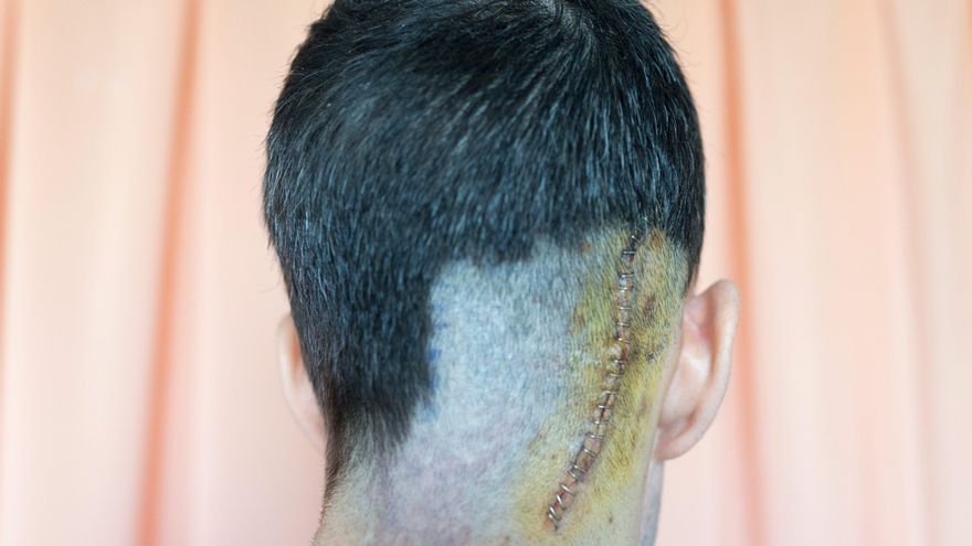 Fotografías para contar el cáncer sin el "lenguaje tóxico" de los medios