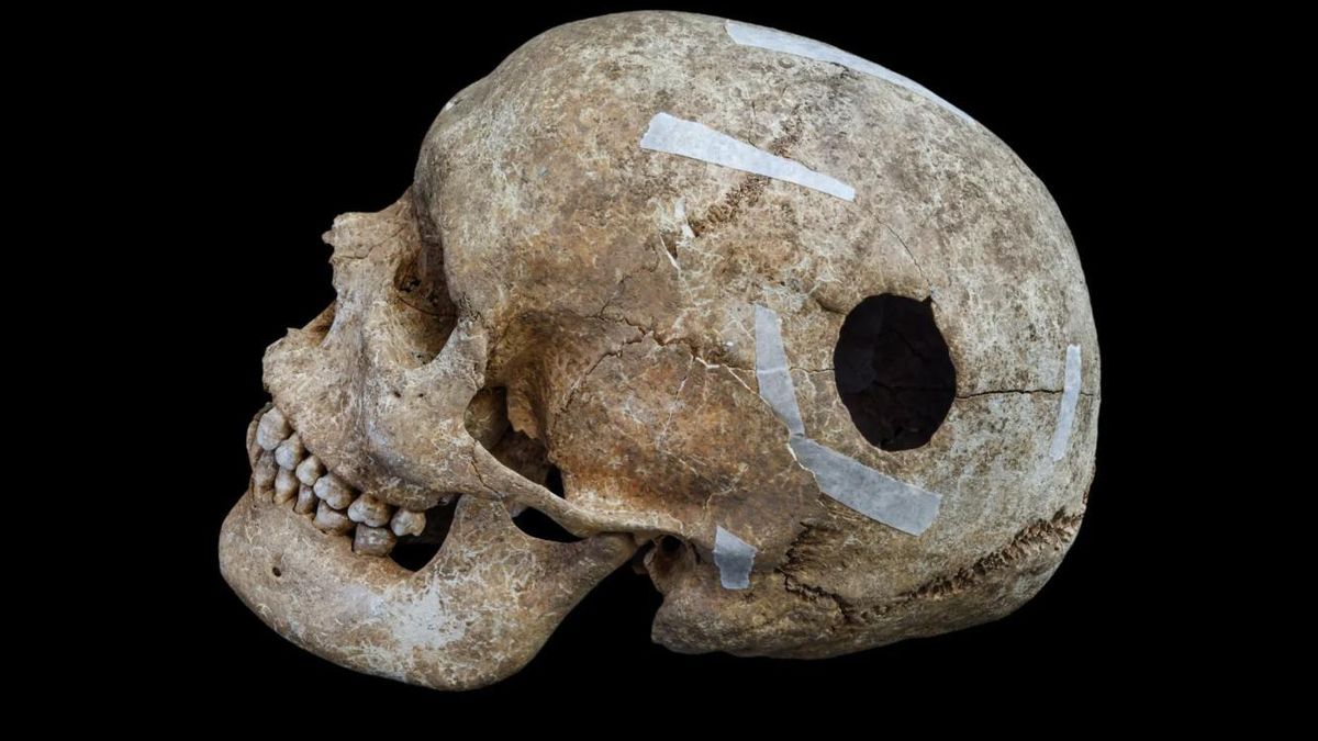 La curadora de las colecciones explicó que ese individuo presentaba rasgos óseos poco comunes y una intervención en el cráneo