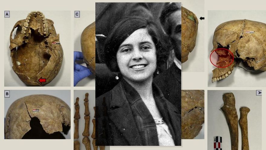 L'autòpsia d'Aurora Picornell, la 'Passionària' de Mallorca, confirma que va ser copejada i crivellada a trets pels franquistes