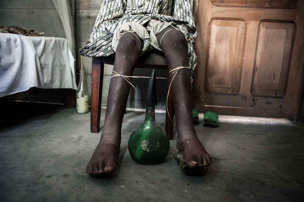 Los curanderos utilizan todo tipo de fetiches para realizar sus ceremonias. Foto: Patrick Meinhardt