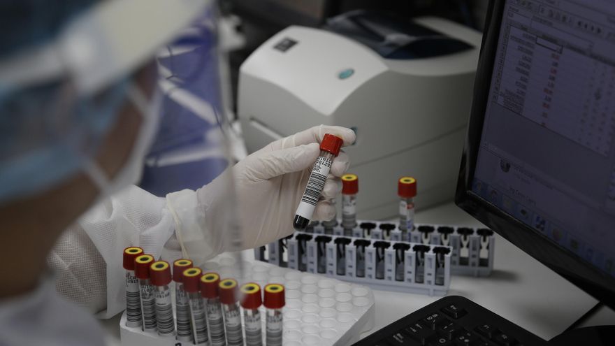Un laboratorista analiza muestras de sangre de pacientes con covid-19 en el Hospital El Salvador, en San Salvador (El Salvador). EFE/Rodrigo Sura/Archivo