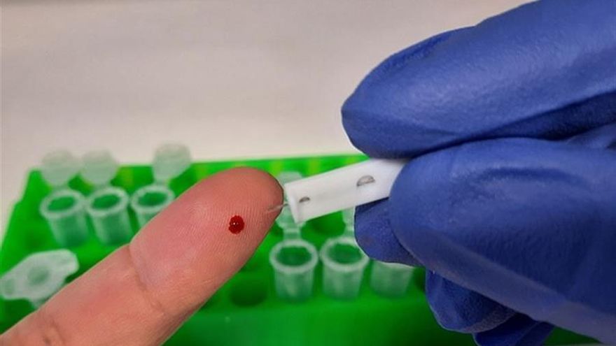 El CSIC diseña un test de anticuerpos para la COVID-19 más sensible y fiable al 99%