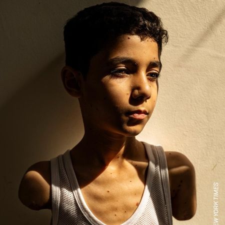 “Mahmoud Ajjour, de nueve años” es la Foto de 2025 en el World Press Photo.