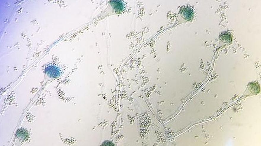 Diversas especies de hongos aspergillus. // DiCyT