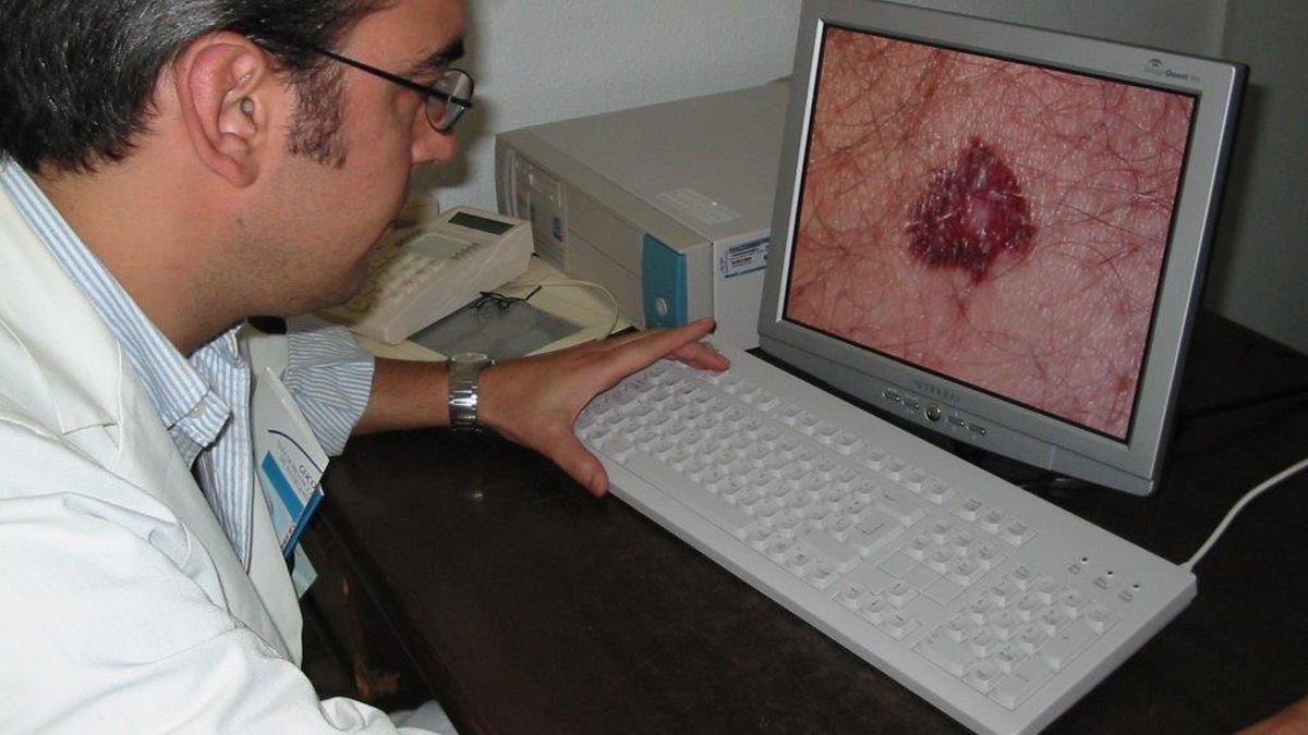 Consulta de teledermatología.