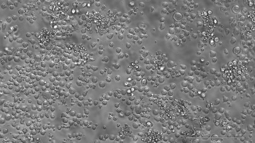 Una investigación española publicada en Nature revela cómo envejece la sangre humana