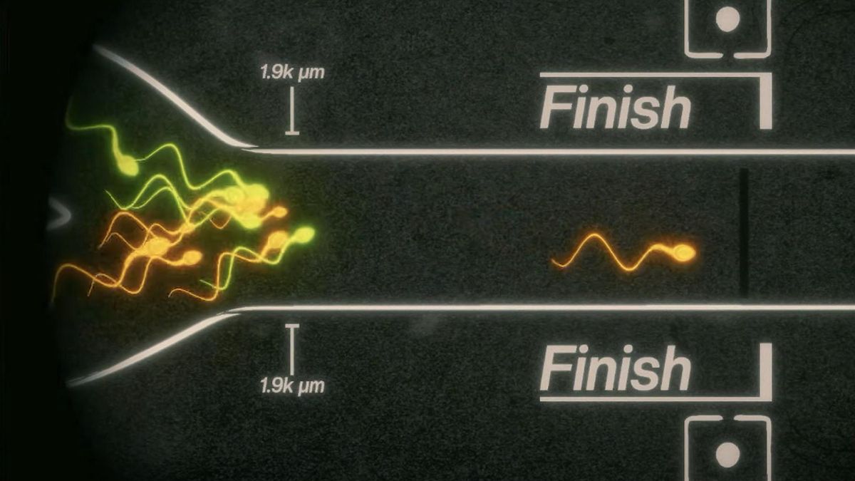 Carreras de espermatozoides, el último episodio de la obsesión de la ‘machosfera’ con el semen
