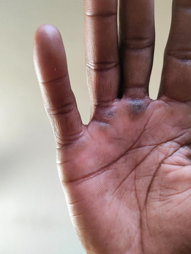 Una imagen de la mano de Adama, esa parte física que representa una parte de su hogar.