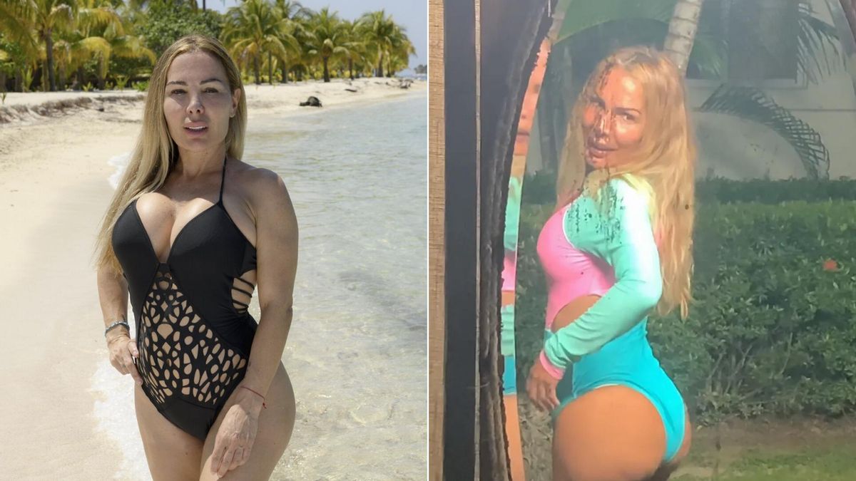 Antes y después de Lorena Morlote (no especificado)