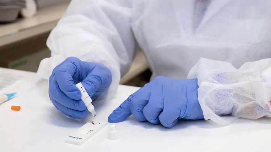 La incidencia cae casi 250 puntos en Extremadura tras el fin de semana