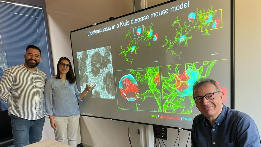Desarrollado el primer modelo genético en ratones para estudiar la enfermedad de Kufs