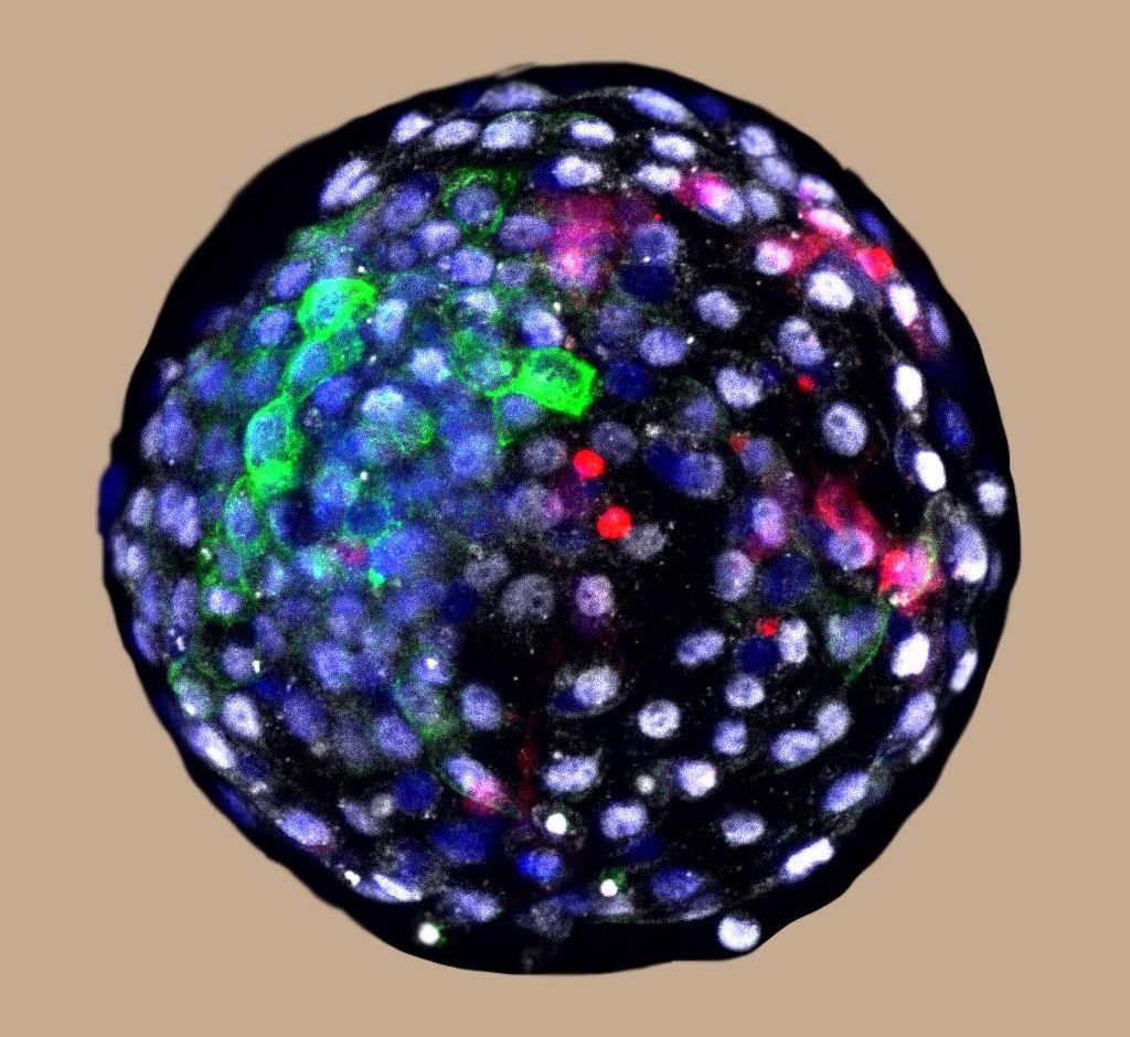 Blastocisto de quimera. / Weizhi Ji, Universidad de Ciencia y Tecnología de Kunming (China)
