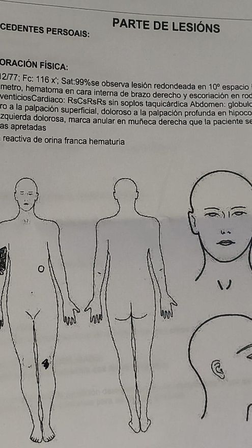 Parte de lesiones de Rosana Prieto antes de la ampliación en la mañana del lunes