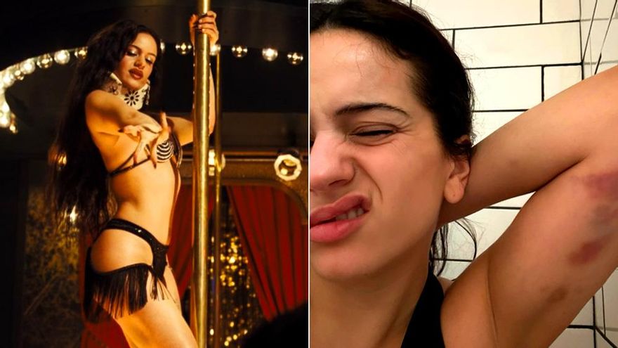 Rosalía desvela los secretos de su fichaje por 'Euphoria' y enseña las 'heridas de guerra' de su papel como 'stripper'