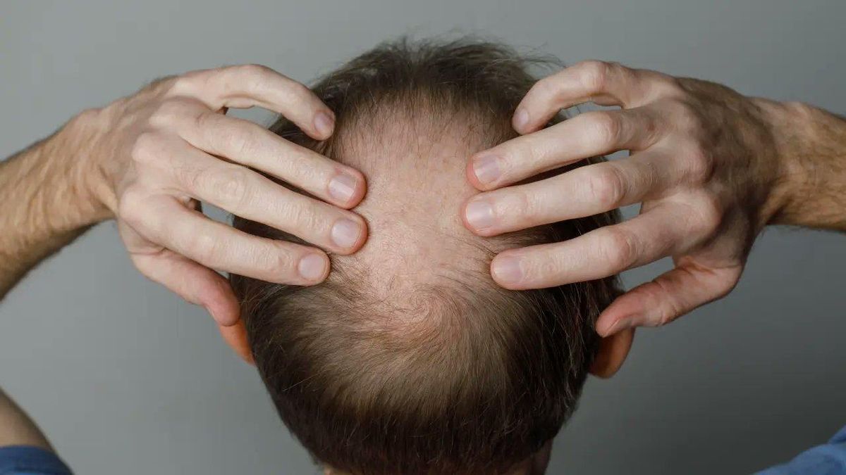 Problemas con el pelo: los dos factores que la ciencia apunta como causantes de la caída capilar