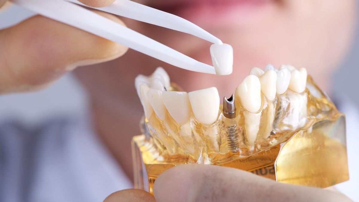 El acceso a los implantes dentales crece en una España cada vez más longeva