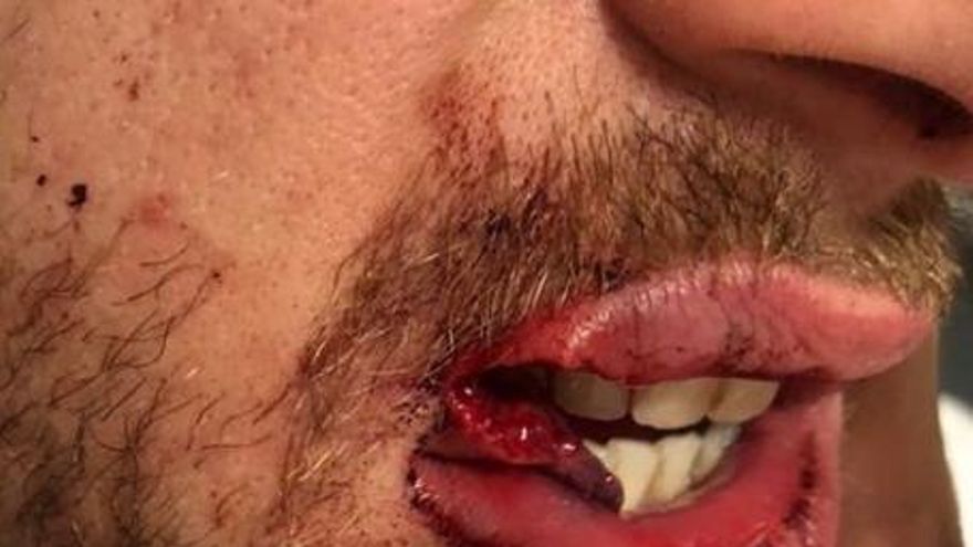 Denuncian una agresión homófoba en Santa Coloma de Gramenet (Barcelona)