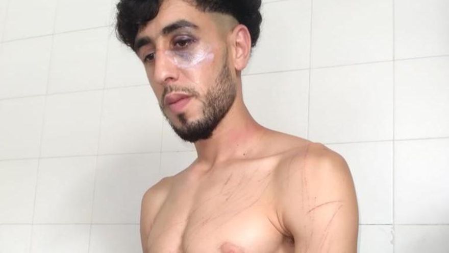 Nueva denuncia por agresión en el CIE de València: un interno asegura que fue golpeado por cuatro agentes cuando se quejó de un dolor de muelas