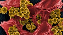 MRSA o por qué España tiene un problema grave con los antibióticos