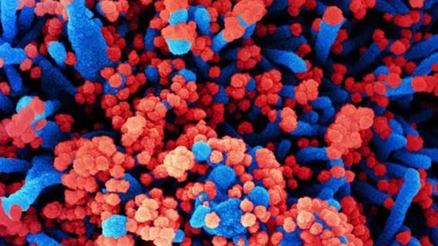 El CSIC produce anticuerpos contra la COVID-19 a partir del sistema inmunitario de los dromedarios