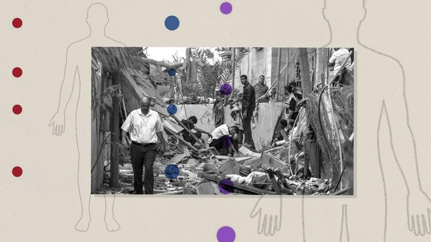 El primer estudio científico en Gaza radiografía una masacre indiscriminada: "Vemos lesiones rara vez observadas en la historia reciente”