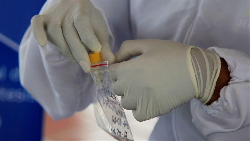 Muestra para pruebas PCR.