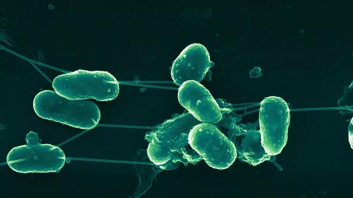 Salud confirma un caso de salmonela en Asturias vinculado al brote de Galicia