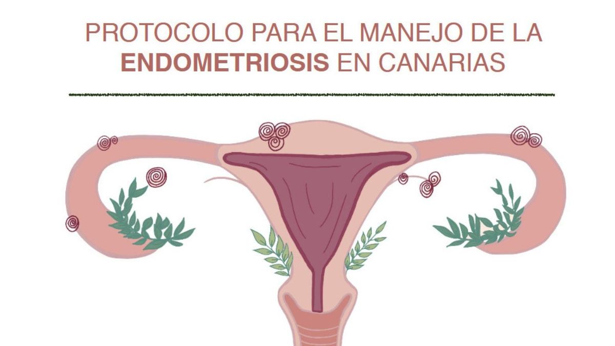 Un total de 12.130 mujeres canarias han sido diagnosticadas de endometriosis