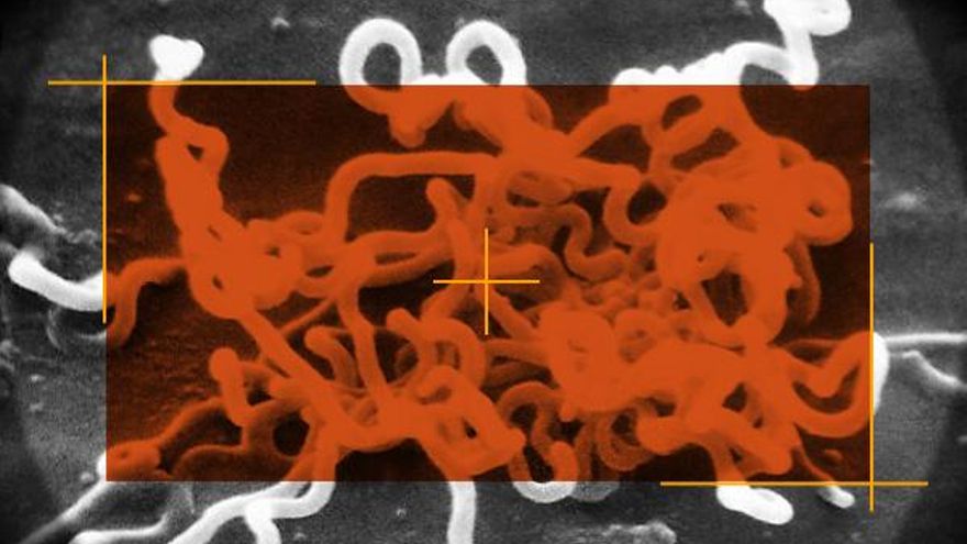 Las enfermedades de transmisión sexual crecen y la sífilis marca récords históricos