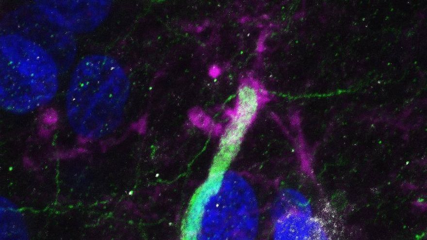 Un estudio español desvela la regeneración de neuronas y explica el daño de las enfermedades degenerativas