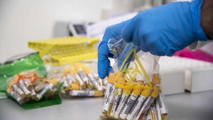 Toma de muestras en un laboratorio italiano .EFE/EPA/LUCA ZENNARO/Archivo
