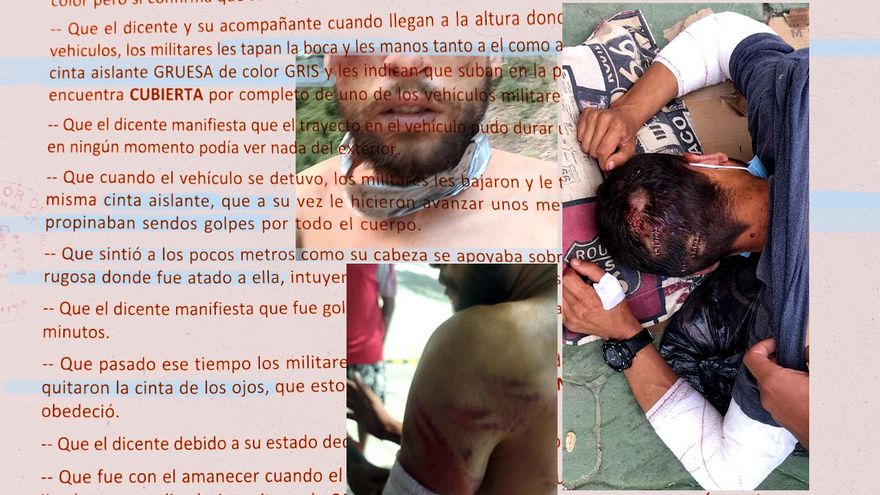 Un migrante denuncia ante la Policía una paliza de militares en Ceuta: "Me llevaron al bosque, me amordazaron y me pegaron"