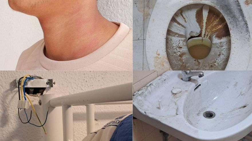 Agresiones, suciedad y ansiolíticos: la acogida de los menores migrantes en Lanzarote llega a la Fiscalía