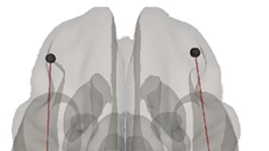 La estimulación cerebral podría mejorar el aprendizaje de las matemáticas