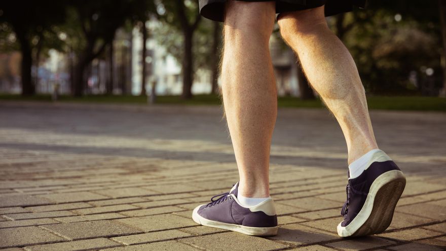 Varices, no son solo un problema estético: por qué debes prestarles atención