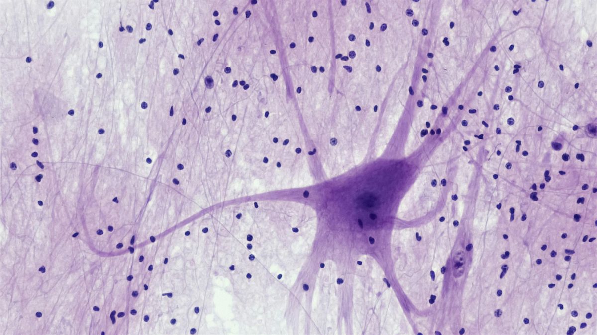 Una imagen microscópica de las neuronas.