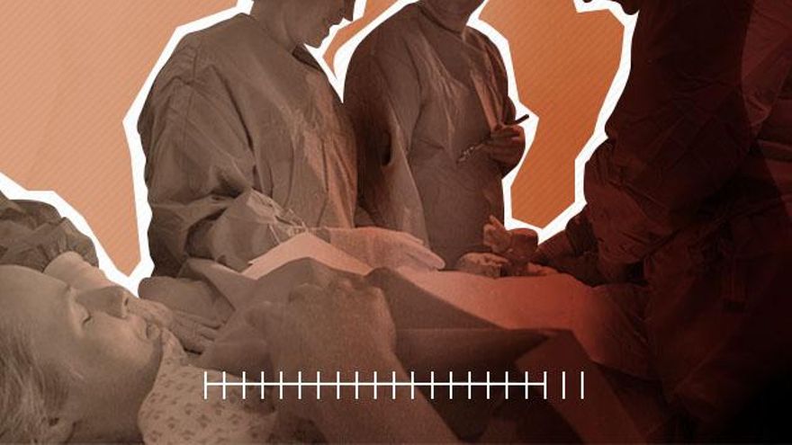 Fábricas de cesáreas: Alicante y Ciudad Real tienen los hospitales con tasas más elevadas de España, de hasta el 60%