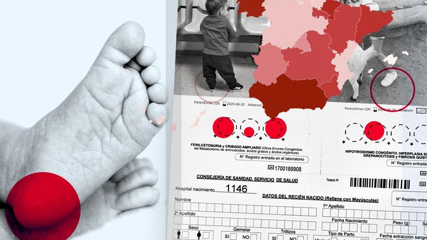 Desigualdad en la 'prueba del talón': milagro o pesadilla según el código postal