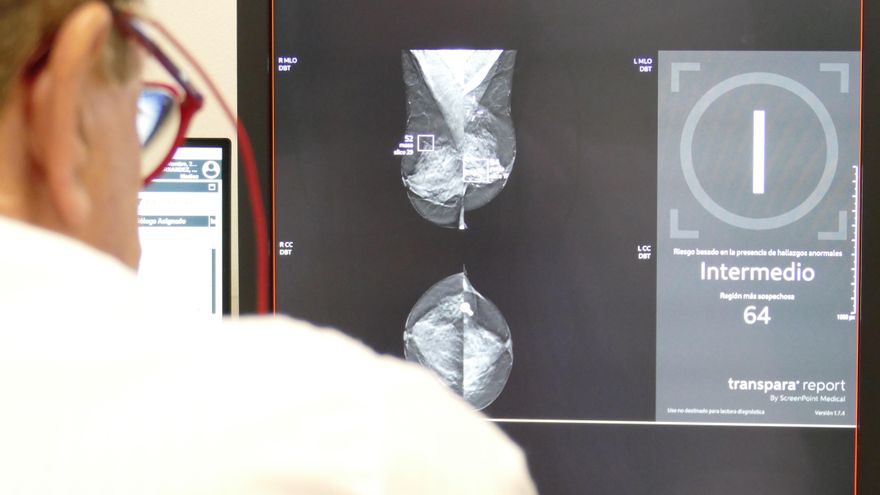 Una mamografía en una imagen de archivo