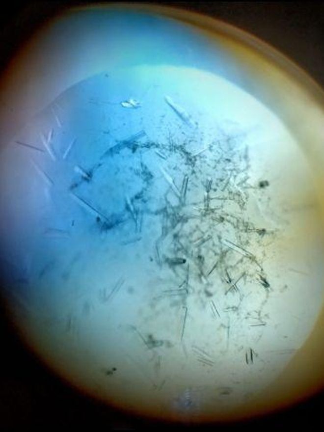 Cristales a través de los que se obtuvo la estructura tridimensional de la proteína mediante difracción de rayos X.