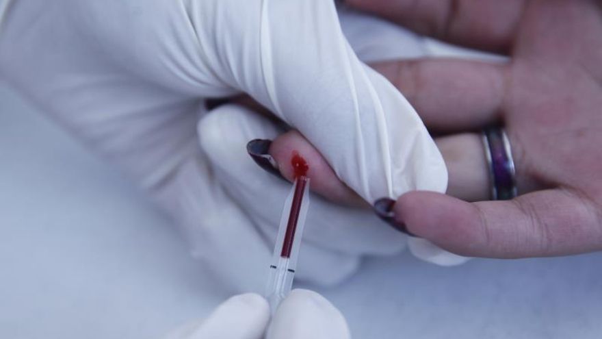 Una persona se realiza una prueba de VIH.