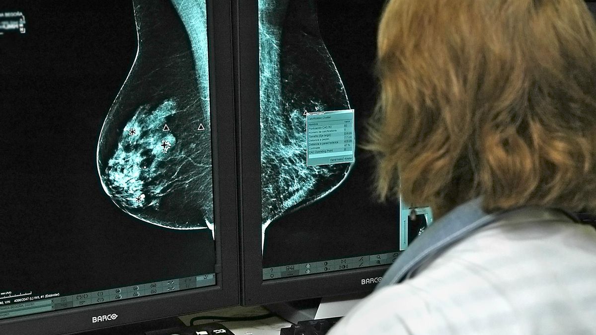 La alcaldesa de Nambroca denuncia "meses" de retraso en el cribado de cáncer de mama entre las vecinas del municipio