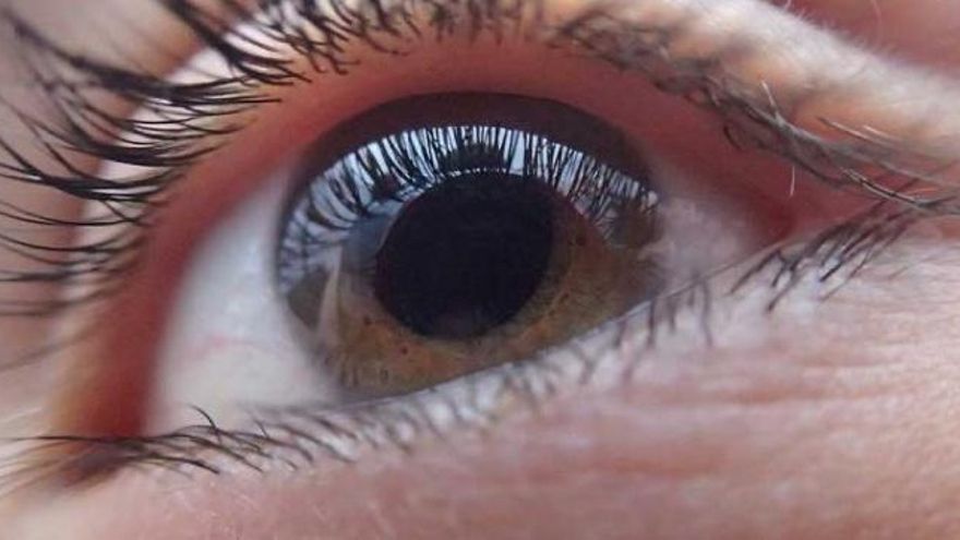 Una dieta para prevenir las cataratas